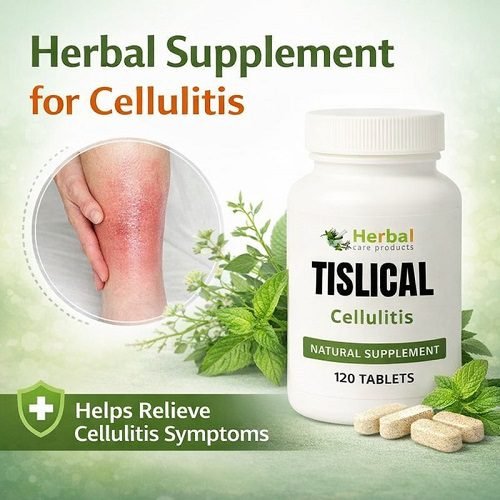 Natural-Treatment-for-Cellulitis.jpg